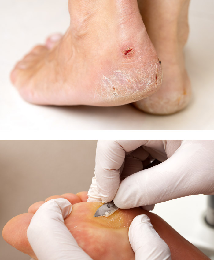 Imagen de la fisioterapeuta utilizando INDIVA de FisioAR